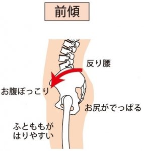 ぽっこりお腹の原因 ｜名古屋の整体・産後骨盤矯正なら尾頭橋整体院グループ